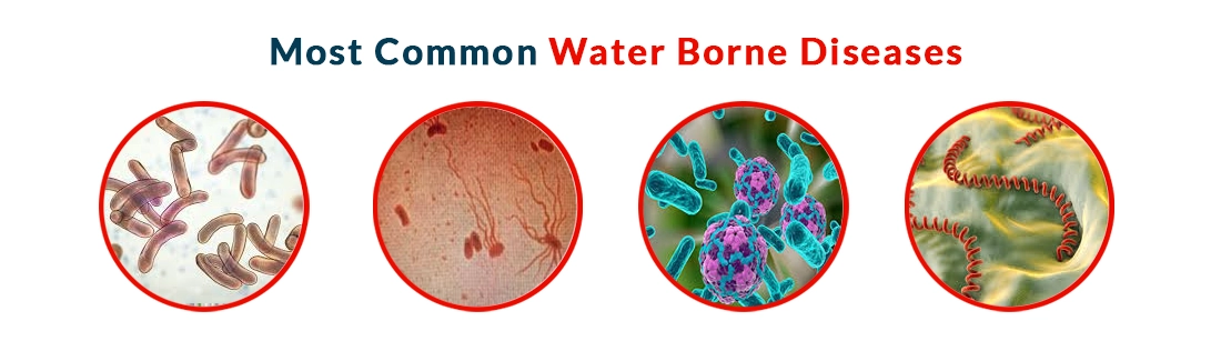 Types Of Water Disease